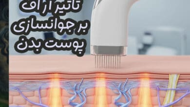 نقش دستگاه لیزر RF فرکشنال در جوانسازی پوست بدن