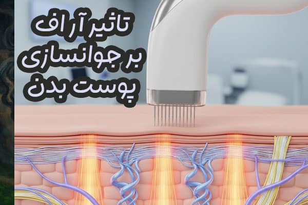 نقش دستگاه لیزر RF فرکشنال در جوانسازی پوست بدن