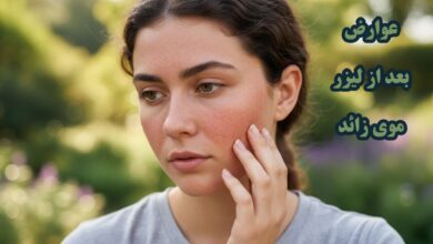 عوارض بعد از لیزر