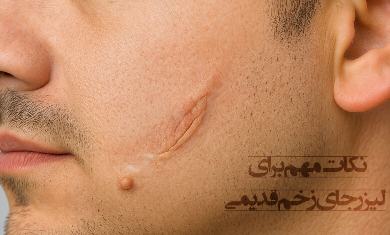 لیزر جای زخم