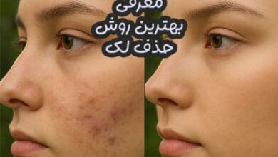 بهترین روش حذف لک