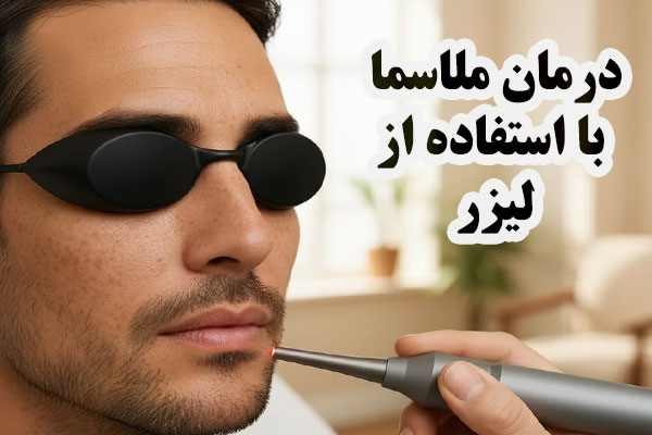 درمان ملاسما با لیزر