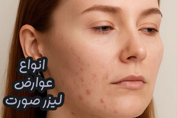 عوارض لیزر پوست صورت