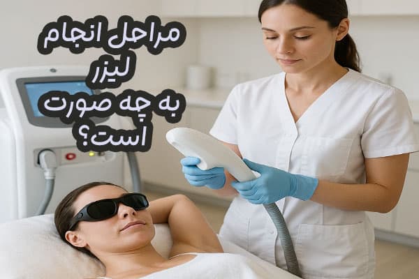 مراحل لیزر موهای زائد