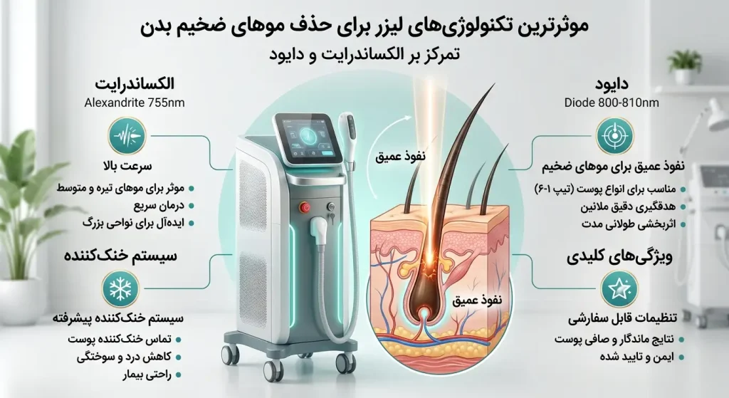موثرترین لیزر برای حذف موهای ضخیم (مردان و زنان) + مزایا