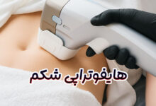 هایفوتراپی شکم