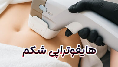 هایفوتراپی شکم