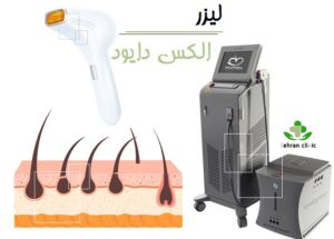 لیزر الکساندرایت یا لیزر دایود