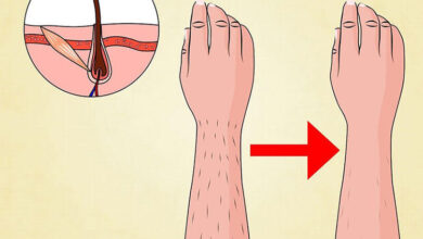 تاثیر لیزر بر فولیکول های مو