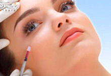 مزوتراپی و مزوژل